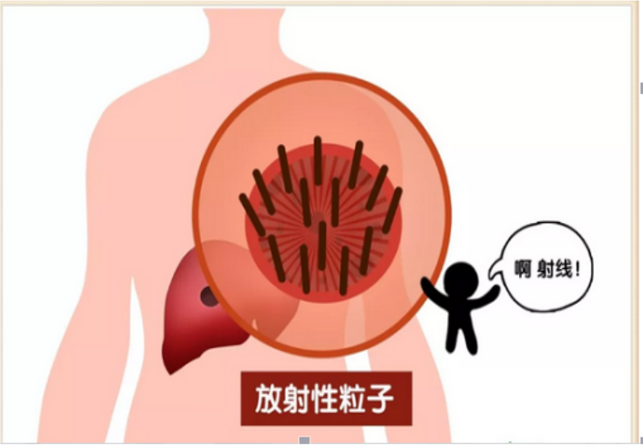 粒子.png