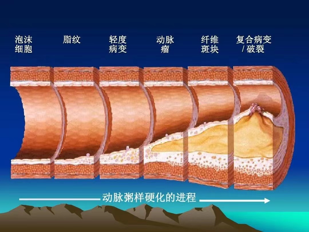 硬化.jpg