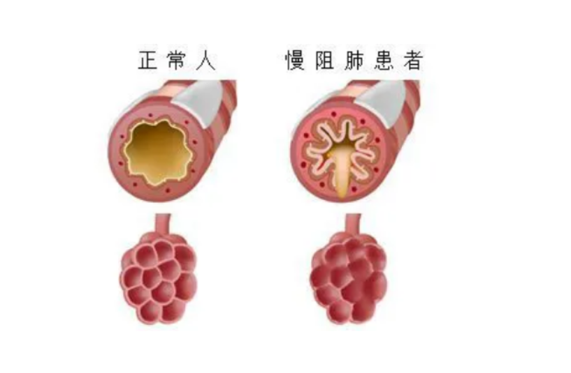 图片14-2.png